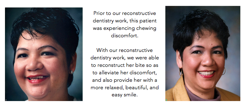 Salinas-Dental-Health-Reconstructive-Dentistry-Before-After