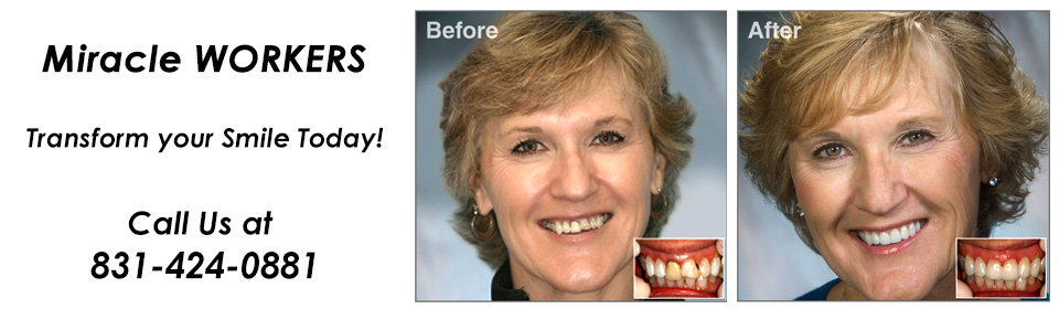 Salinas-Dental-Health-cosmetic-dentistry-Andresen